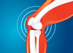 Advanced Treatments for Hip and Knee Pain Webinar